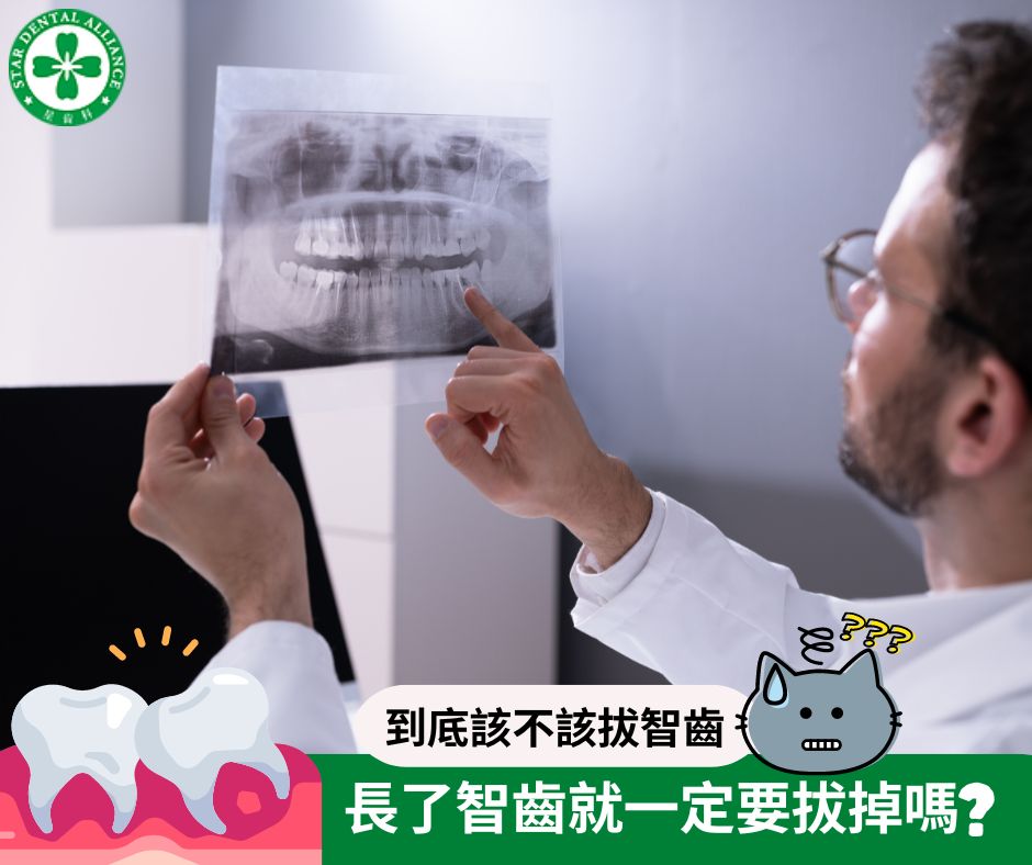 智慧齒一定要拔掉嗎_Stardental