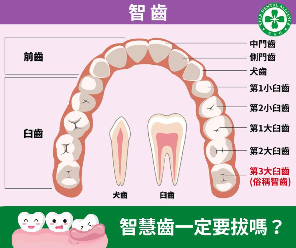 如何知道自己長智慧齒_Stardental