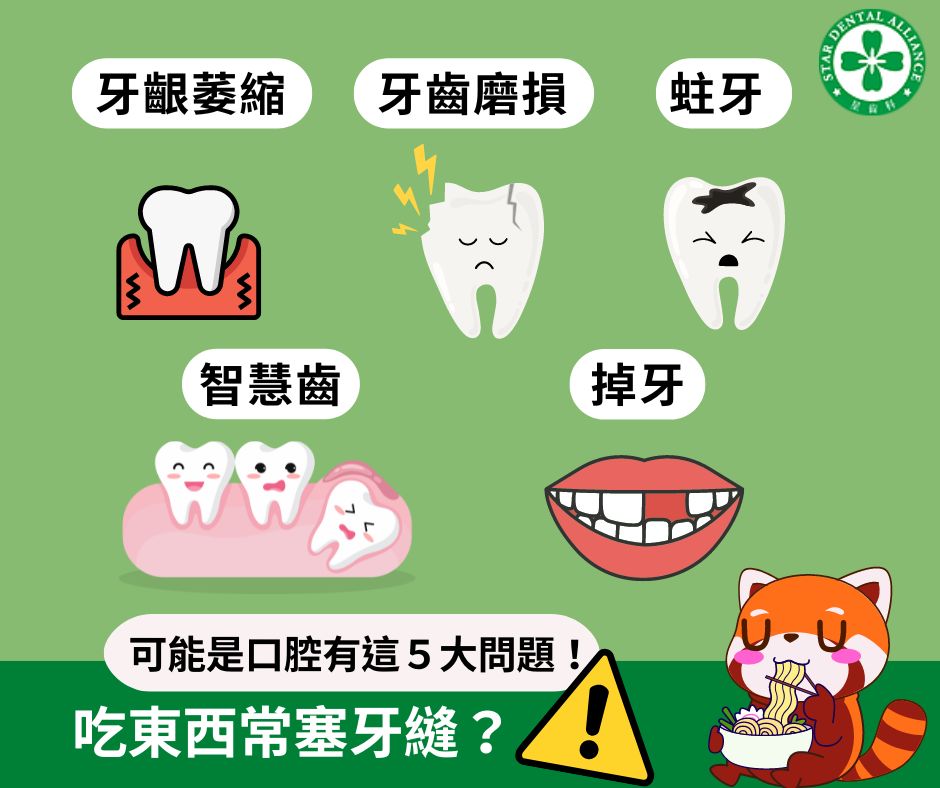 吃東西常塞牙縫_可能是口腔有這５大問題_Stardental