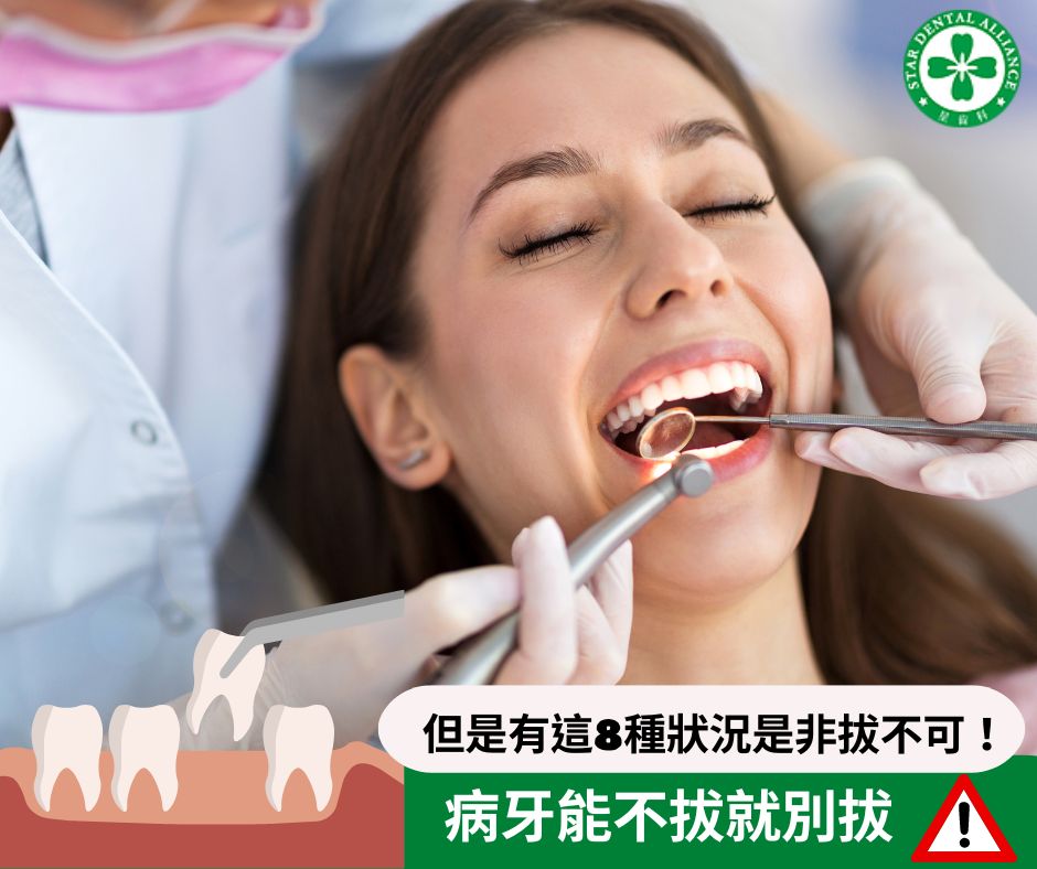 病牙能不拔就別拔_Stardental