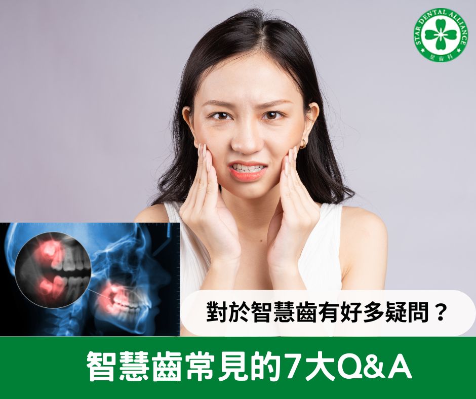 智齒常見7大QA | Stardental