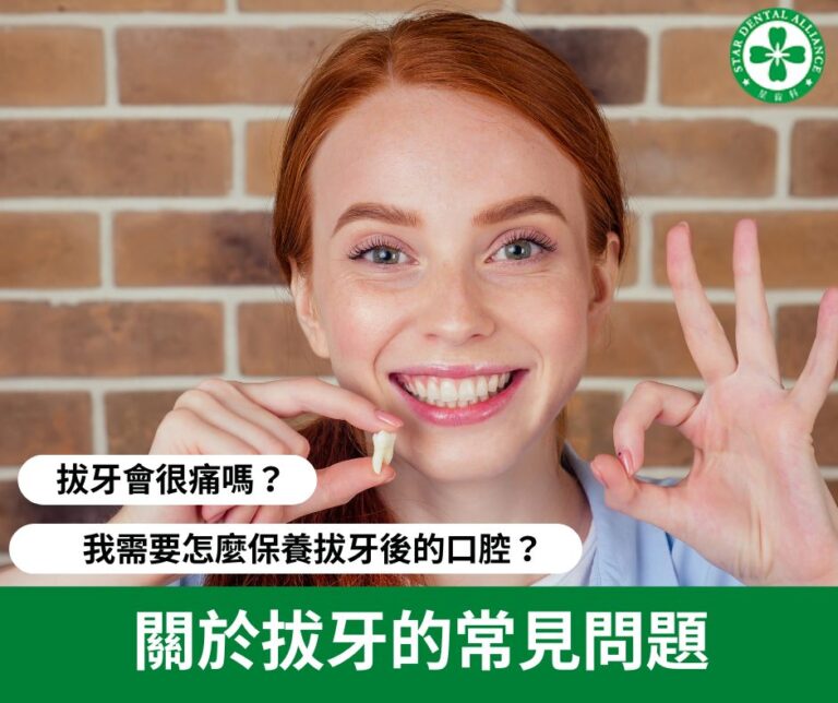 關於拔牙的常見問題_Stardental