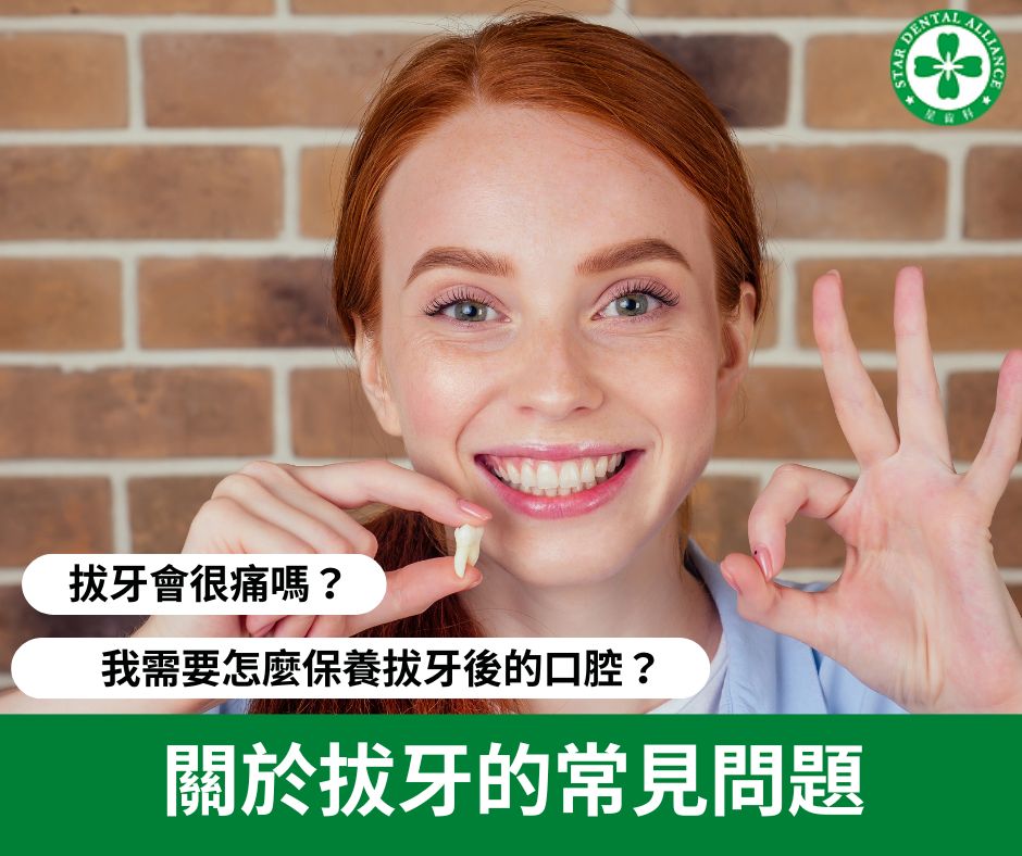 關於拔牙的常見問題_Stardental